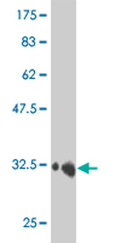 HEY1 monoclonal antibody (M01), clone 3B3