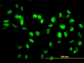 SIRT1 monoclonal antibody (M01), clone 7B7