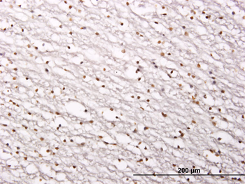 SIRT1 monoclonal antibody (M01), clone 7B7