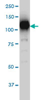 SIRT1 monoclonal antibody (M01), clone 7B7