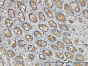 EXOC7 monoclonal antibody (M01), clone 1D4