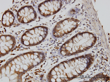 RGL1 monoclonal antibody (M01), clone 2D10