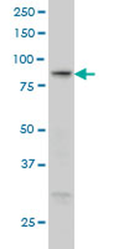 RGL1 monoclonal antibody (M01), clone 2D10