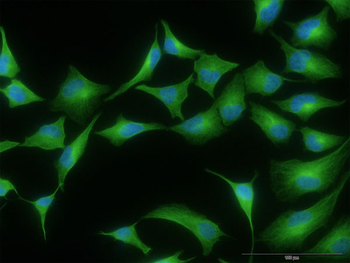 STAB1 monoclonal antibody (M05), clone 4G9