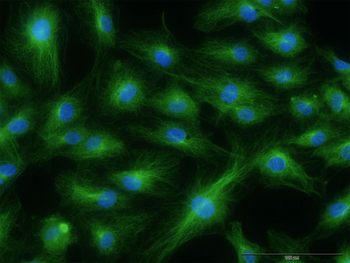 STAB1 monoclonal antibody (M05), clone 4G9