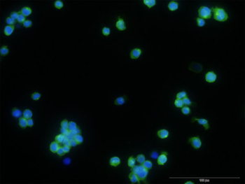 STAB1 monoclonal antibody (M05), clone 4G9