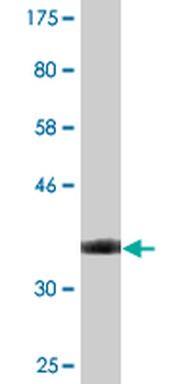 STAB1 monoclonal antibody (M05), clone 4G9