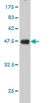 EPB41L3 monoclonal antibody (M01), clone 2B1