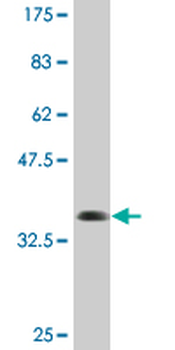 TNRC6B monoclonal antibody (M12), clone 3G11