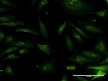 NMNAT2 monoclonal antibody (M04), clone 2G8