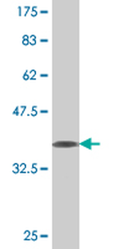 NMNAT2 monoclonal antibody (M02), clone 4E6