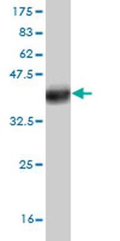 TNIK monoclonal antibody (M03), clone 3D4