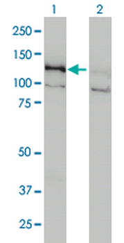 DAAM1 monoclonal antibody (M05), clone 5D3