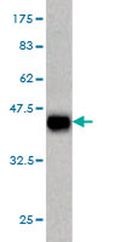 DAAM1 monoclonal antibody (M05), clone 5D3