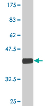 SV2C monoclonal antibody (M01), clone 3D8