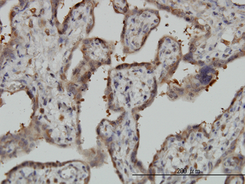 NT5C2 monoclonal antibody (M02), clone 3C1