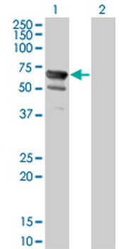 NT5C2 monoclonal antibody (M02), clone 3C1
