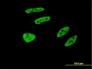 TRIM32 monoclonal antibody (M09), clone 2E5