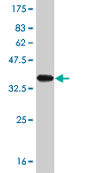 TRIM32 monoclonal antibody (M09), clone 2E5