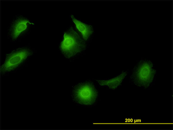 CCT5 monoclonal antibody (M01), clone 4E5-4B1