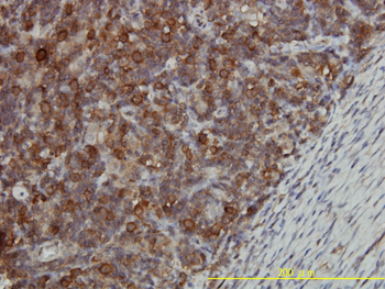 CCT5 monoclonal antibody (M01), clone 4E5-4B1