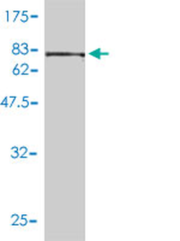 CCT5 monoclonal antibody (M01), clone 4E5-4B1