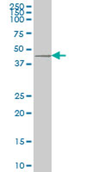DKK1 monoclonal antibody (M11), clone 2A5