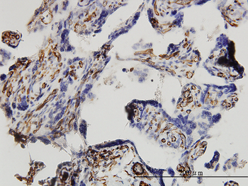 DKK1 monoclonal antibody (M11), clone 2A5
