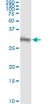 DKK1 monoclonal antibody (M11), clone 2A5