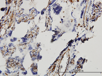 DKK1 monoclonal antibody (M08), clone 2B12