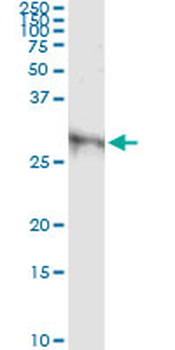 DKK1 monoclonal antibody (M08), clone 2B12