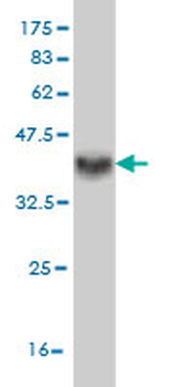 DKK1 monoclonal antibody (M01), clone 4D4
