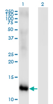 MSRB2 monoclonal antibody (M01), clone 2B7