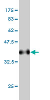 MSRB2 monoclonal antibody (M01), clone 2B7