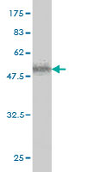 ICK polyclonal antibody (A01)