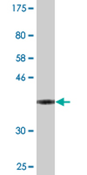 VASH1 monoclonal antibody (M05), clone 4A3