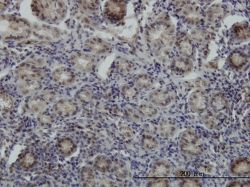 STK38 monoclonal antibody (M03), clone 6F1