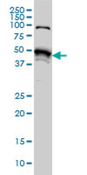 STK38 monoclonal antibody (M03), clone 6F1