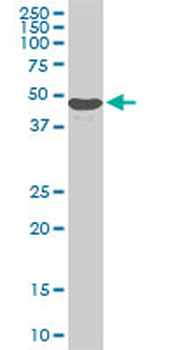 STK38 monoclonal antibody (M03), clone 6F1