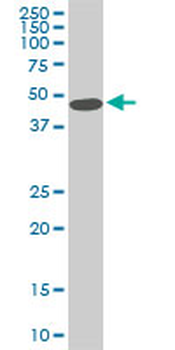 STK38 monoclonal antibody (M03), clone 6F1