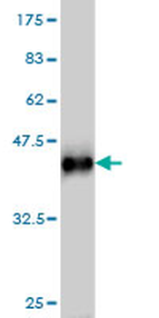 STK38 monoclonal antibody (M03), clone 6F1