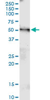 MGAT4B monoclonal antibody (M01), clone 1F4