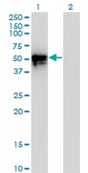 KLF8 monoclonal antibody (M12), clone 3F10