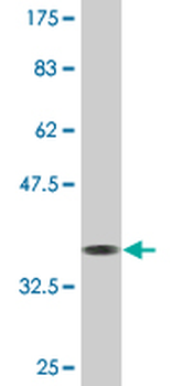 KLF8 monoclonal antibody (M12), clone 3F10