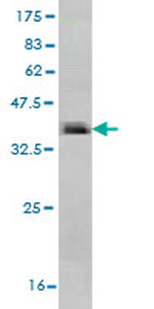 PADI2 monoclonal antibody (M01), clone 4D4