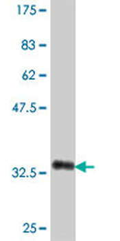 CA5B polyclonal antibody (A01)