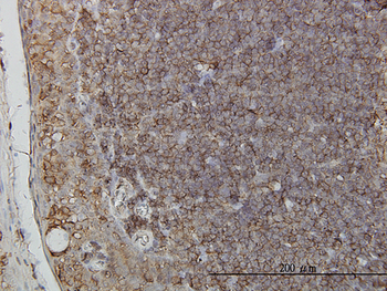 RNF139 monoclonal antibody (M01), clone 3D10