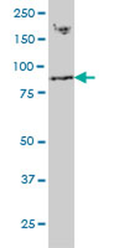 RNF139 monoclonal antibody (M01), clone 3D10