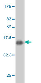 RNF139 monoclonal antibody (M01), clone 3D10