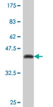 DUSP10 polyclonal antibody (A01)